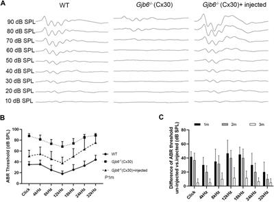 Virally Mediated Connexin 26 Expression in Postnatal Scala Media Significantly and Transiently Preserves Hearing in Connexin 30 Null Mice